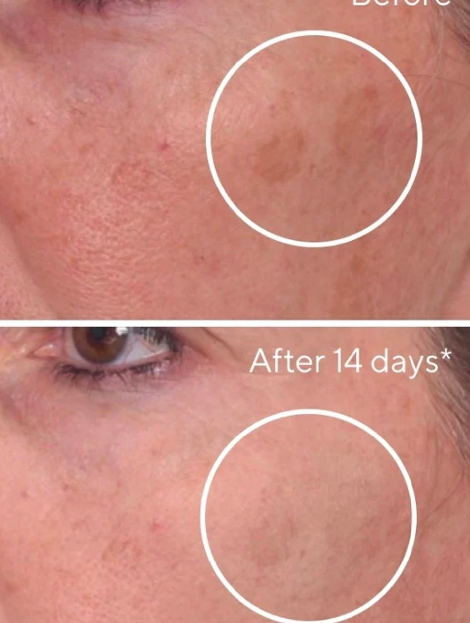 Rapid Dark Spot Correcting Serum