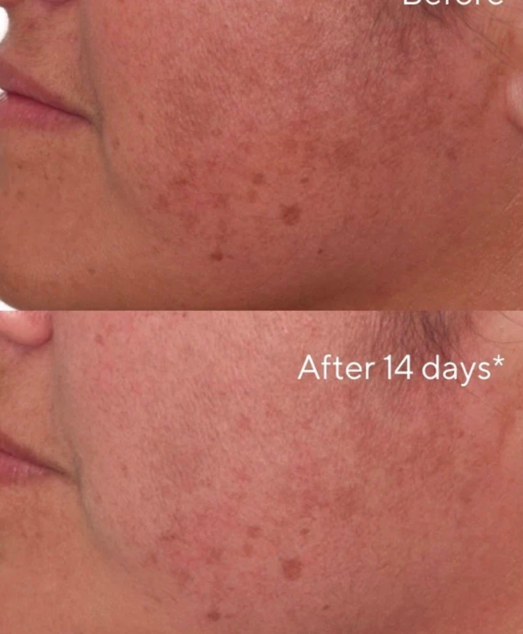 Rapid Dark Spot Correcting Serum