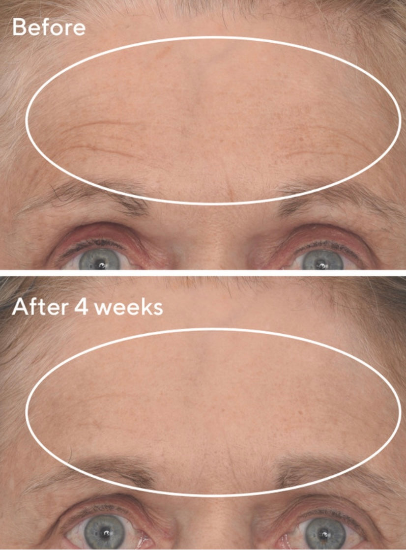 Retinal ReSculpt™ Overnight Treatment