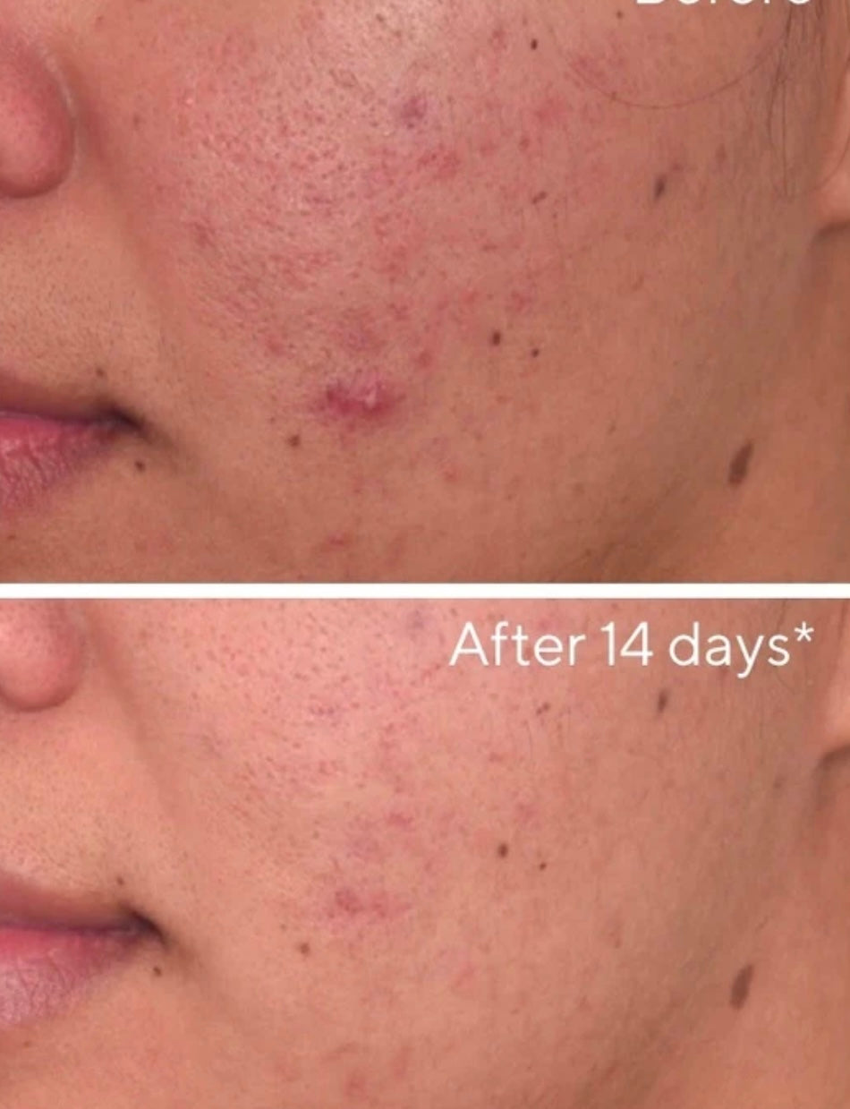 Rapid Dark Spot Correcting Serum