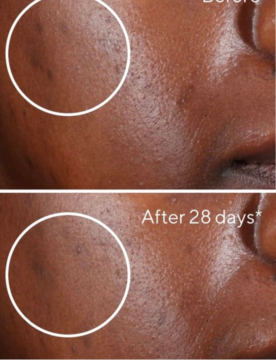 Rapid Dark Spot Correcting Serum